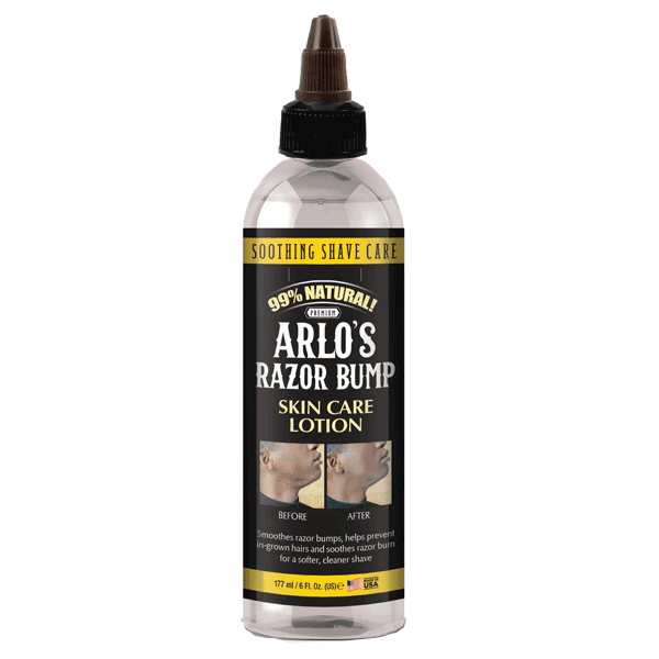 Arlo's Razor Bump Skin Care Lotion 6 oz.