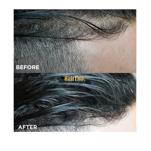 Supreme HairThik Hair Fibers Kit